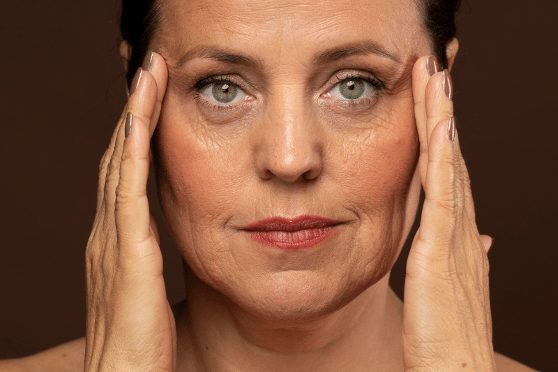flacidez facial flacidez facial