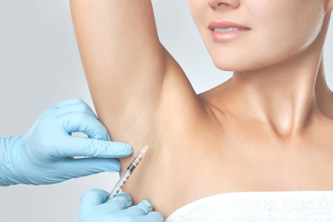 Hiperidrose Como o Botox Pode Resolver o Suor Indesejado Hiperidrose: Como o Botox Pode Resolver o Suor Indesejado