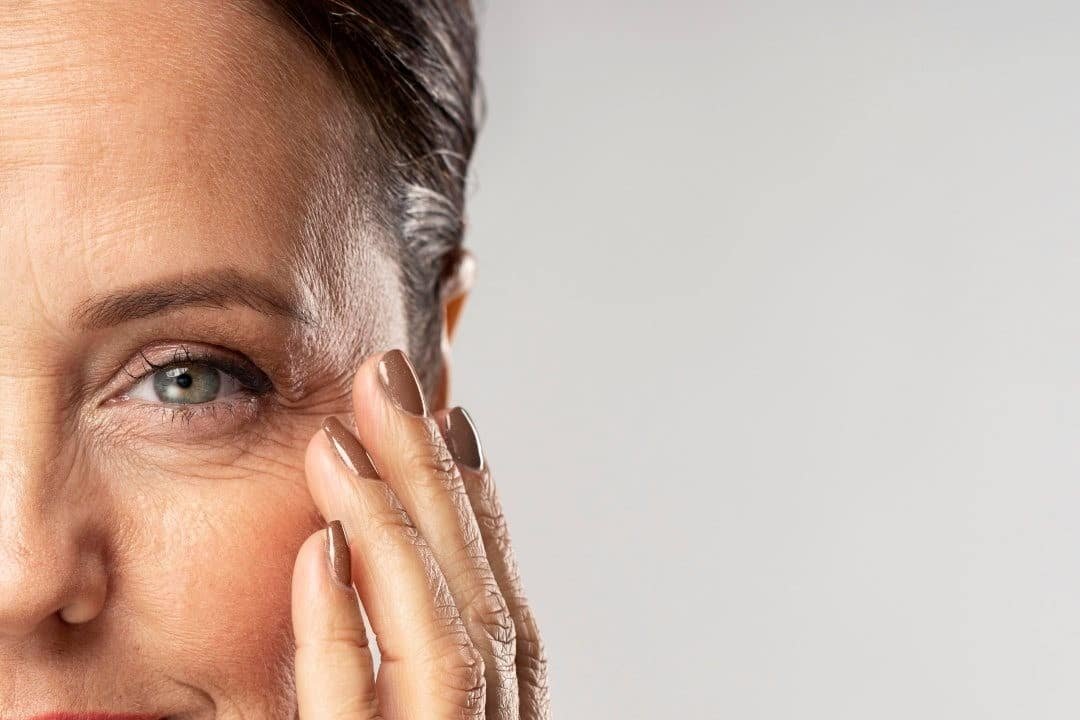 Ácido Hialurônico nas Linhas Finas dos Olhos Hidratação Profunda com Naturalidade Ácido Hialurônico nas Linhas Finas dos Olhos: Hidratação Profunda com Naturalidade