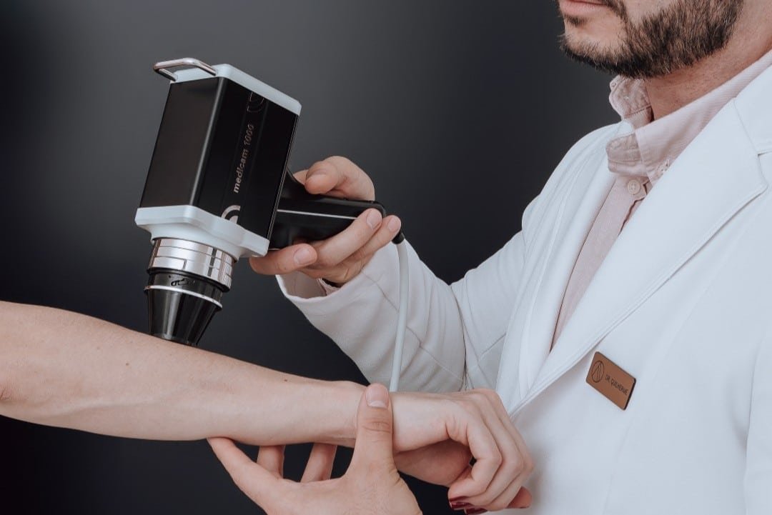 FotoFinder tecnologia que salva vidas no diagnóstico do câncer de pele FotoFinder: tecnologia que salva vidas no diagnóstico do câncer de pele