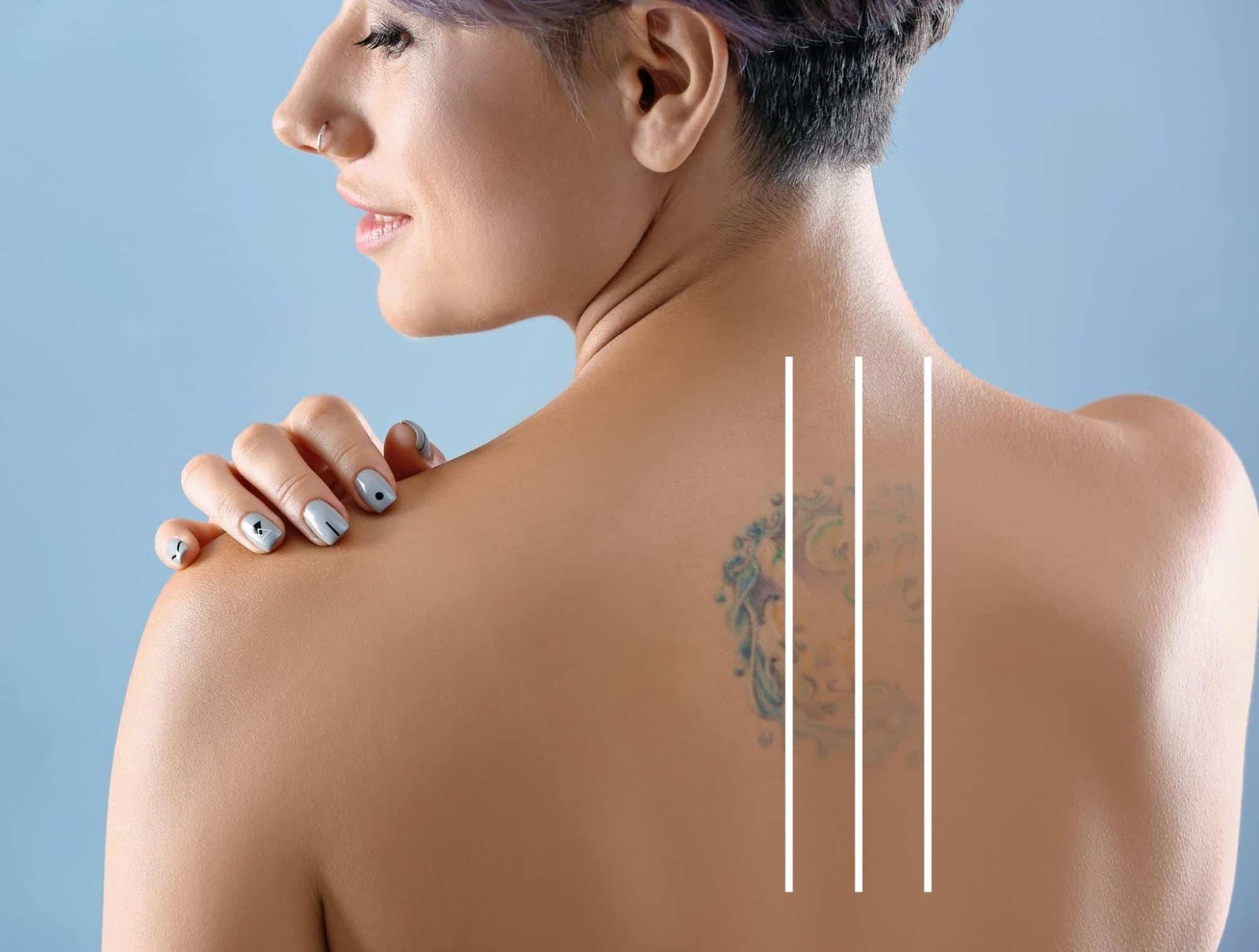 post-tattoo-removal-aftercare post-tattoo-removal-aftercare